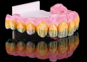 Dung dịch màu Prettau® Aquarell từ hãng Zirkonzahn