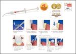 Traxodent: Hemodent Paste Retraction System