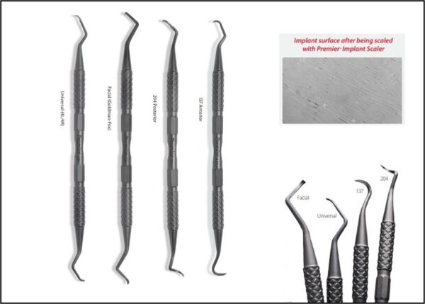 Premier® Implant Scalers