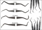 Premier® Implant Scalers