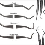 Premier® Implant Scalers